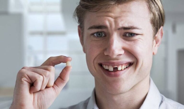 Mơ Thấy Gãy Răng Đánh Số Gì? Cơ Hội Trúng Đề Từ Giấc Mơ 17 Mơ Thấy Gãy Răng Đánh Số Gì? Cơ Hội Trúng Đề Từ Giấc Mơ